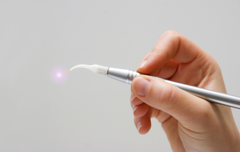 Image of a hand holding a laser treatment device. 